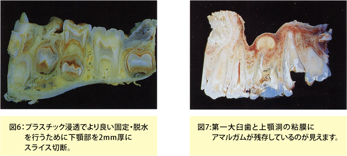 インプラント・非脱灰標本