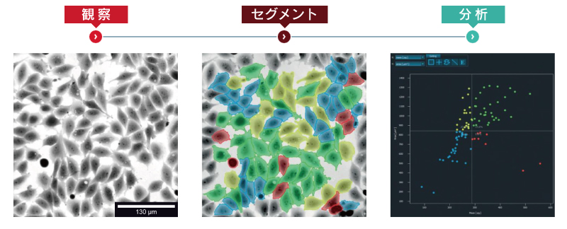 【観察-セグメント-分析】
イメージングサイトメトリー用ホログラフィック顕微鏡 Q-PHASE